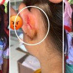 សាហាវពេកហើយ!! ជួយស៊ែមួយផងបងប្អូន!! ក្មេងស្រីពិការម្នាក់ត្រូវគ្រូបង្រៀនមួលស្លឹកត្រចៀកទាល់តែចេញឈាម…(មានរូបភាព)